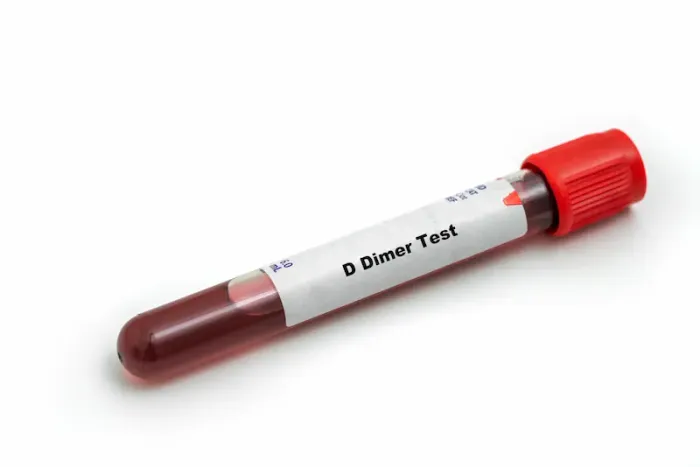 D Dimer Blood Test Overview and Procedure